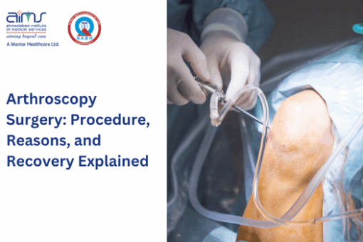 Arthroscopy Surgery: Procedure, Reasons, and Recovery Explained