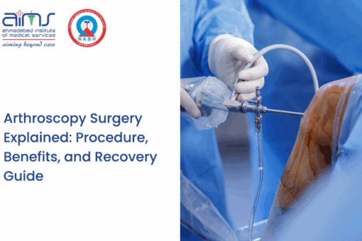 Arthroscopy Surgery Explained