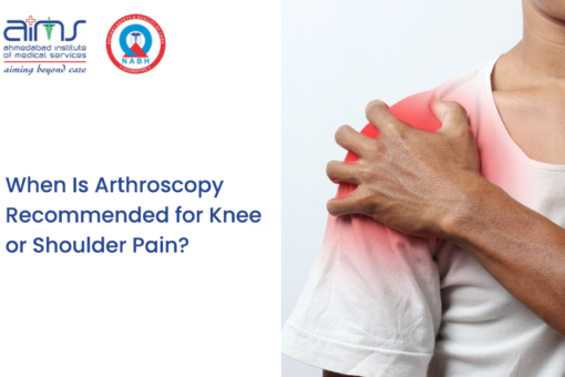 Arthroscopy Recommended for Knee